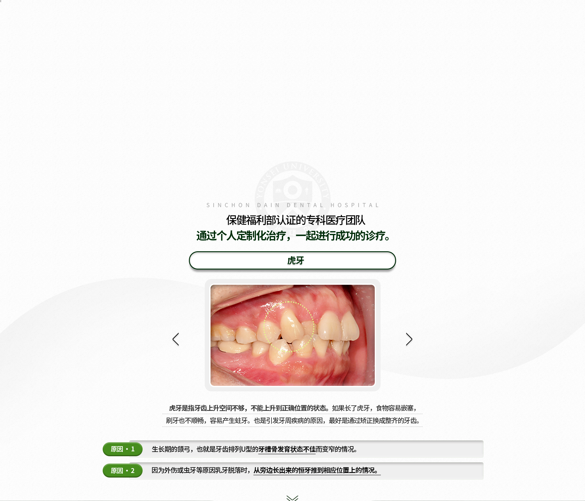 덧니-치아가-올라올-공간이-부족해-제-위치에-올라오지-못하는-상태-음식물이-잘-끼고-칫솔질이-제대로-되지-않아-충치가-생길-위험이-높으며,-치주질환의-원인이-됨-원인1-성장기에-치아가-배열되는-U자형-모양의-잇몸-뼈의-발육이-부진해서-좁아진-경우-원인2-외상이나-충치-등의-이유로-유치가-너무-일찍-빠졌을-때-옆에서-나오고-있던-영구치가-그-자리로-밀고-들어온-경우