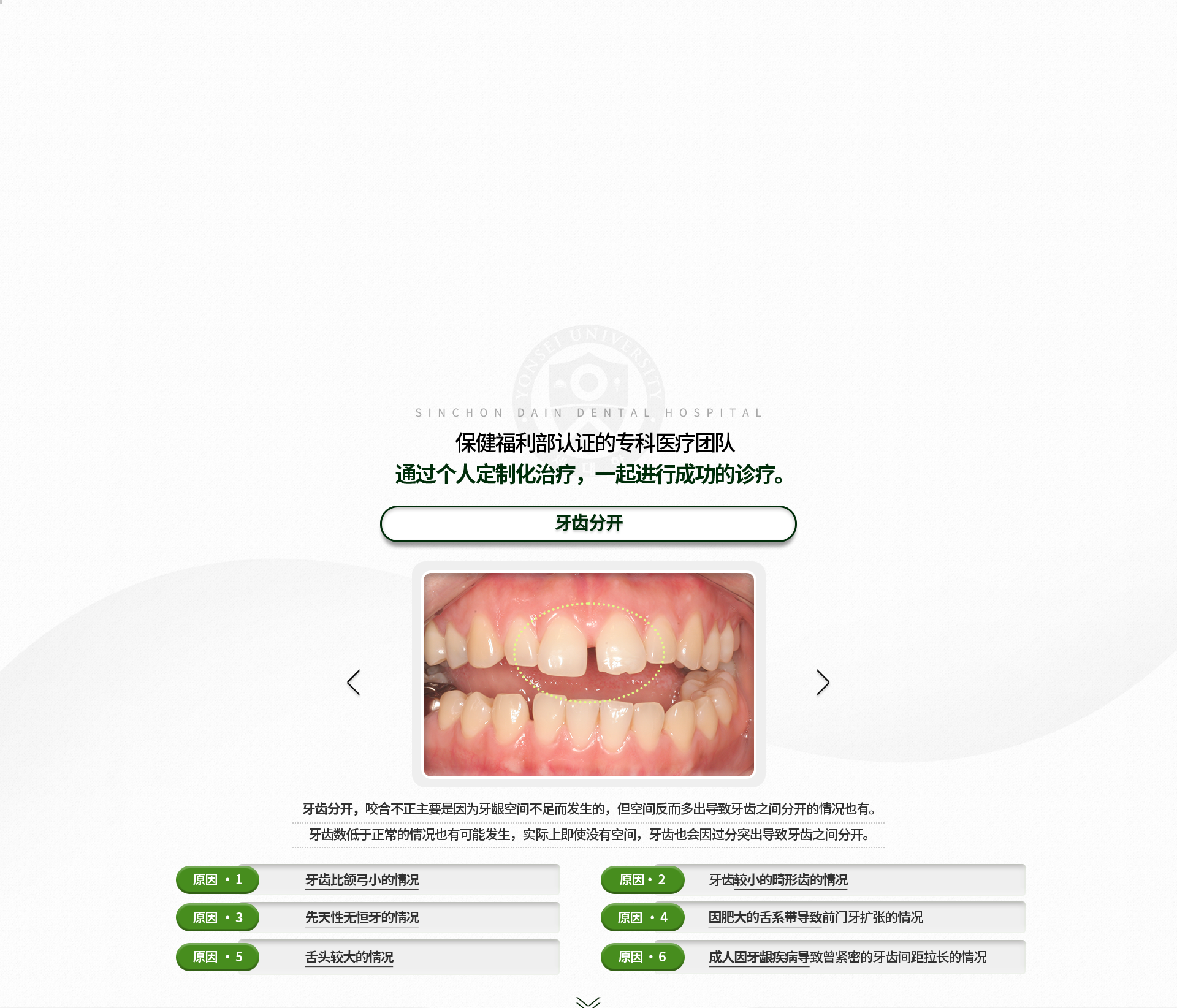 벌어진-치아-부정교합은-주로-잇몸의-공간이-부족하여-생기지만-공간이-오히려-남아서-치아-사이가-벌어지는-경우도-있음-치아-수가-정상보다-적은-경우도-생길-수-있고,-실제적으로-공간이-남지-않아도-치아가-지나치게-돌출되어-치아-사이가-벌어지는-경우도-있음-원인1-악궁에-비해-치아의-크기가-작은-경우-원인2-치아크기가-왜소한-기형치가-있는-경우-원인3-선천적으로-영구치가-없는-경우-원인4-비대한-순소대로-앞니가-벌어진-경우-원인5-혀가-큰-경우-원인6-성인에-잇몸질환이-진행되어-긴밀했던-치아-사이가-벌어진-경우