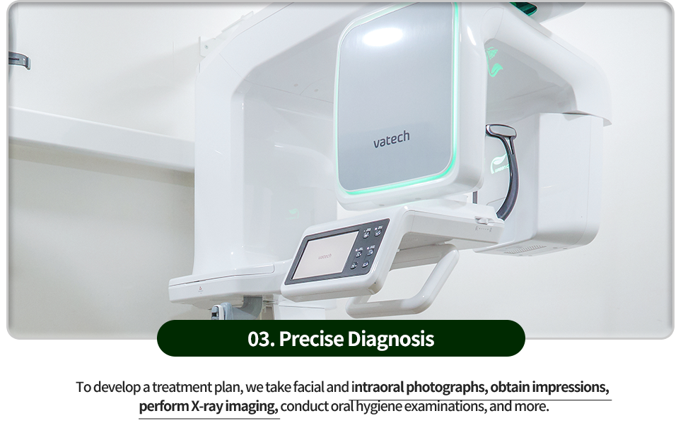 03)-정밀검사-치료계획을-위해-안면사진과-구강내-사진촬영,-인상채득,-X_ray-촬영,-구강-위생검사-등을-진행합니다