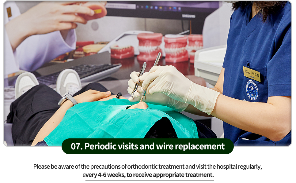 07)-주기적인-내원과-와이어-교체-교정치료의-주의사항을-잘-인지하시고-4~6주마다-정기적으로-내원하여-적절한-치료를-받습니다