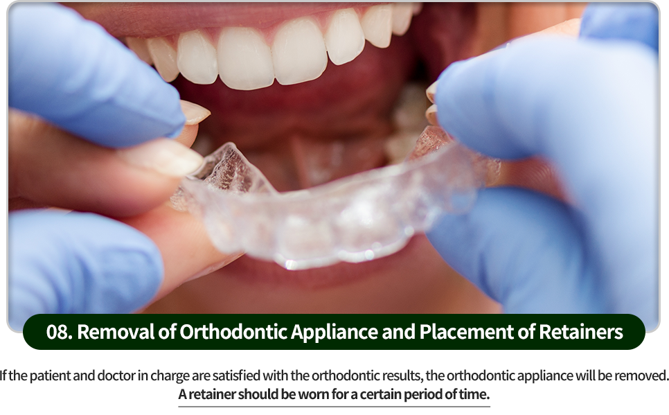 08)-교정장치-제거와-유지장치-장착-환자분과-담당-의사가-교정-결과에-만족하면-교정장치를-제거합니다-일정기간-동안-유지장치를-부착해야합니다