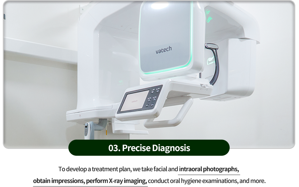 03)-정밀검사-치료계획을-위해-안면사진과-구강내-사진촬영,-인상채득,-X_ray-촬영,-구강-위생검사-등을-진행합니다
