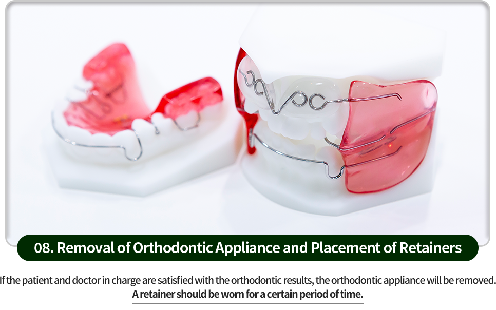 08)-교정장치-제거와-유지장치-장착-환자분과-담당-의사가-교정-결과에-만족하면-교정장치를-제거합니다-일정기간-동안-유지장치를-부착해야합니다
