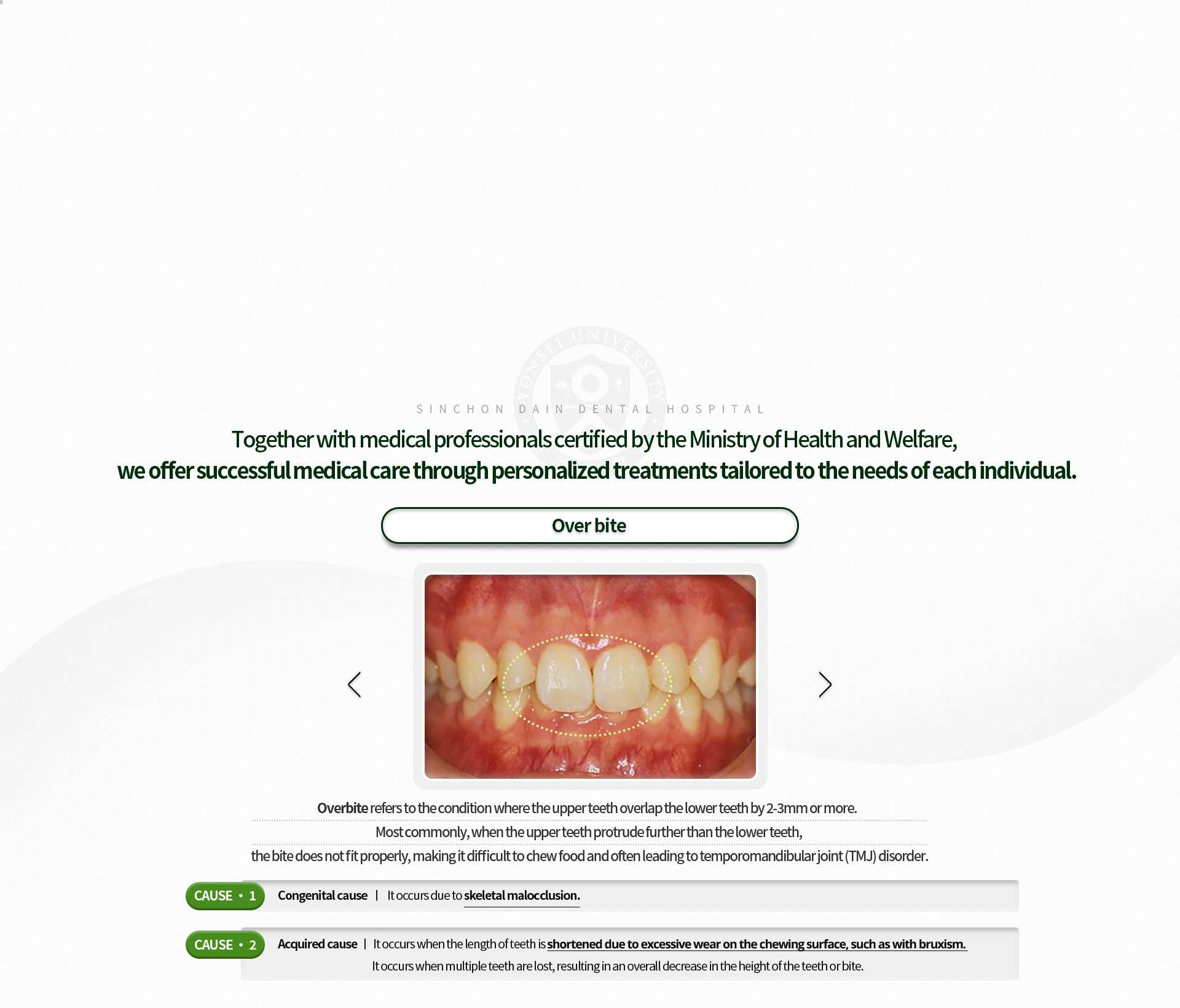 과개교합-윗니가-아랫니를-2~3mm이상-덮는-것-음식을-씹는-것도-힘들어-턱관절-장애가-있는-경우가-많음-원인1-선천적-원인-골격성-부정교합-원인2-후천적-원인-이갈이-등으로-인해-어금니-부위가-과도하게-마모되어-치관의-길이가-짧아진-경우,-여러-개의-어금니가-상실되어-전체적으로-치아의-높이,-즉-교합이-낮아진-경우