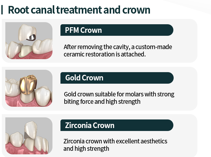 신경치료-및-크라운-종류1-PFM-크라운-충치를-제거한-후-맞춤-제작된-세라믹-보철물을-부착합니다-종류2-골드-크라운-강도가-강해-씹는힘이-강한-어금니-부위에-적합합니다-종류3-지르코니아-크라운-심미적으로-우수하고-강도가-높습니다