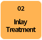 2단계-인레이치료-선택됨