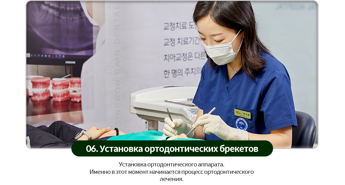 06)-교정장치-브라켓-부착-교정장치를-부착합니다-이제-본격적으로-교정을-시작하는-단계입니다